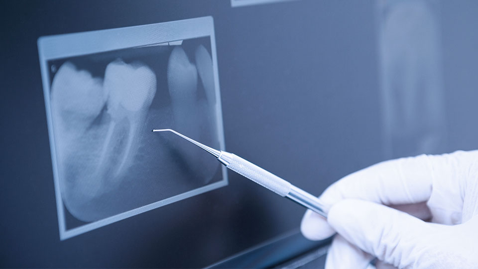 Dentist concept for children with tools in glass cup